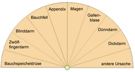 Pendeltafel, um die Ursache für Bauchschmerzen zu ermitteln